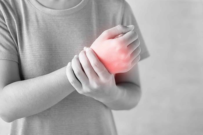 3 Things you should know about Carpal Tunnel Syndrome